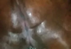 Ärzte Stirn schmückt einen flauschigen frauenporno orgasmus Wollknäuel
